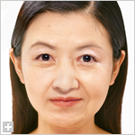 老化